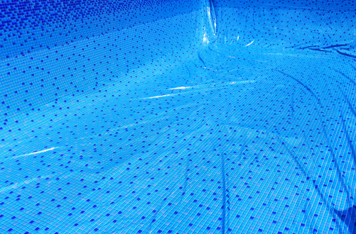 Ilustrasi kerutan. Ini penyebab bisa terjadi.