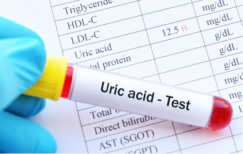 Penyebab Kolam Renang Keruh Pasca Shocking Treatment – Part 2