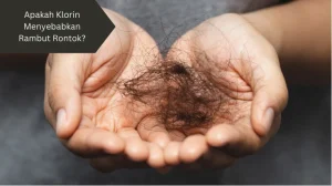 Ilustrasi rambut rontok. Ini penjelasan tentang klorin menyebabkan rambut rontok.
